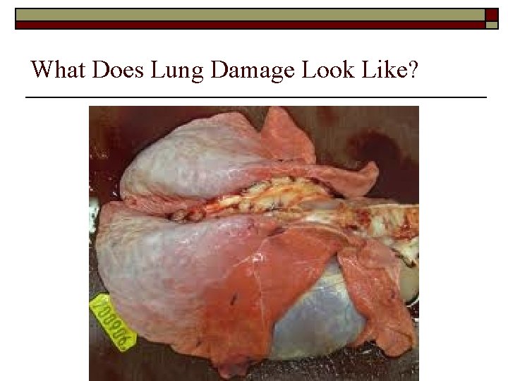 What Does Lung Damage Look Like? 