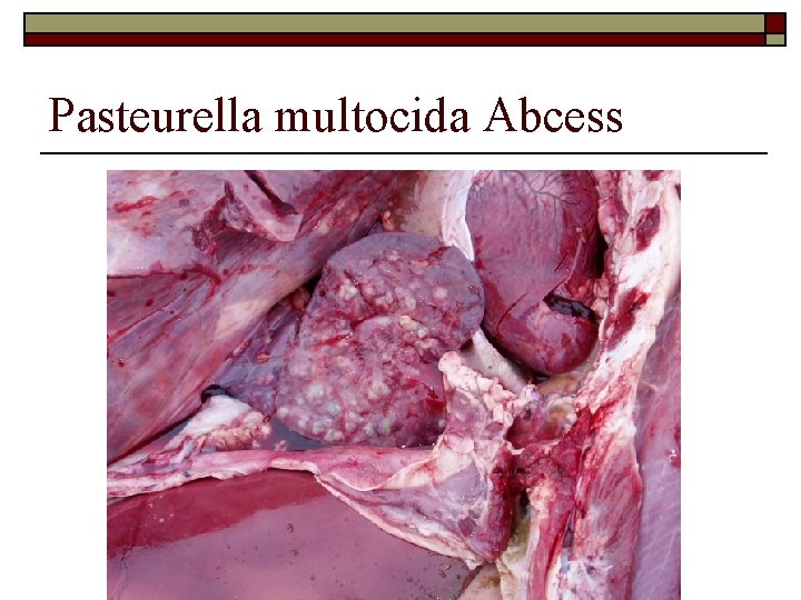 Pasteurella multocida Abcess 