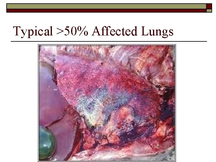 Typical >50% Affected Lungs 