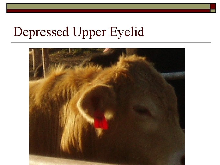 Depressed Upper Eyelid 