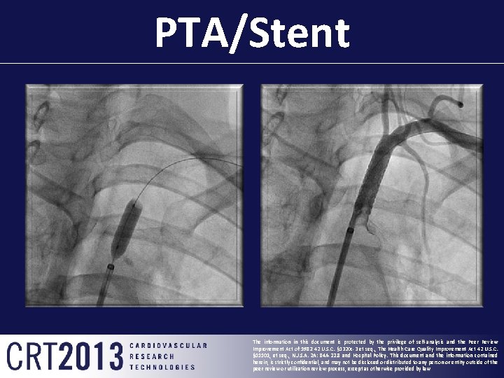 PTA/Stent The information in this document is protected by the privilege of self-analysis and