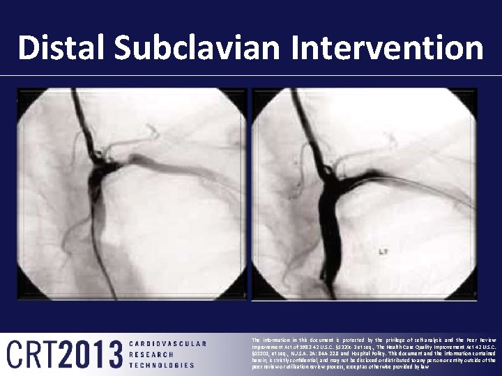Distal Subclavian Intervention The information in this document is protected by the privilege of