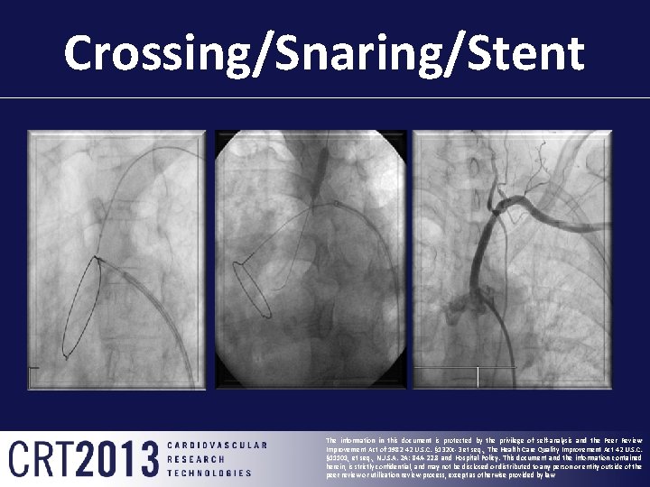 Crossing/Snaring/Stent The information in this document is protected by the privilege of self-analysis and