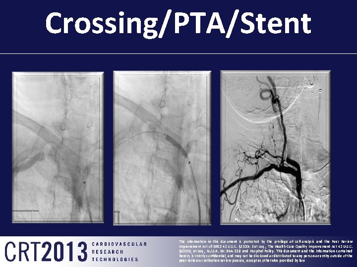 Crossing/PTA/Stent The information in this document is protected by the privilege of self-analysis and