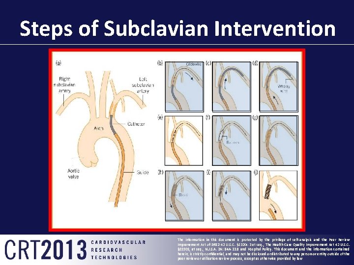Steps of Subclavian Intervention The information in this document is protected by the privilege