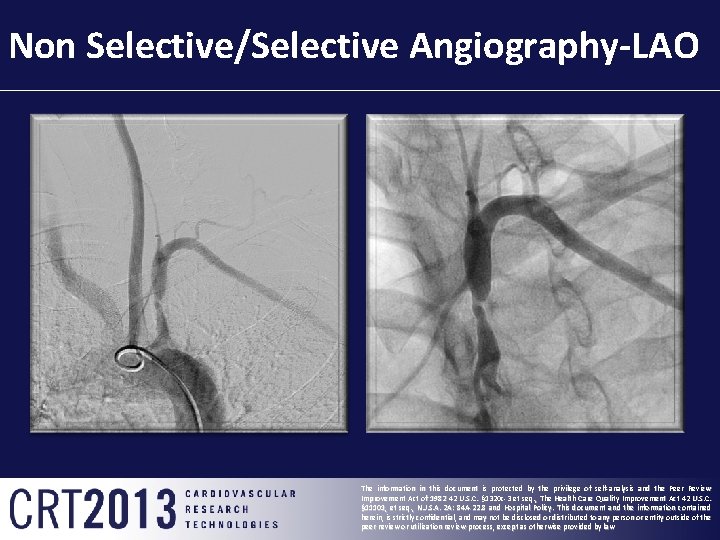 Non Selective/Selective Angiography-LAO The information in this document is protected by the privilege of