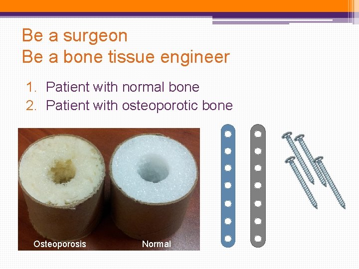 Be a surgeon Be a bone tissue engineer 1. Patient with normal bone 2. Be a surgeon Be a bone tissue engineer 1. Patient with normal bone 2.