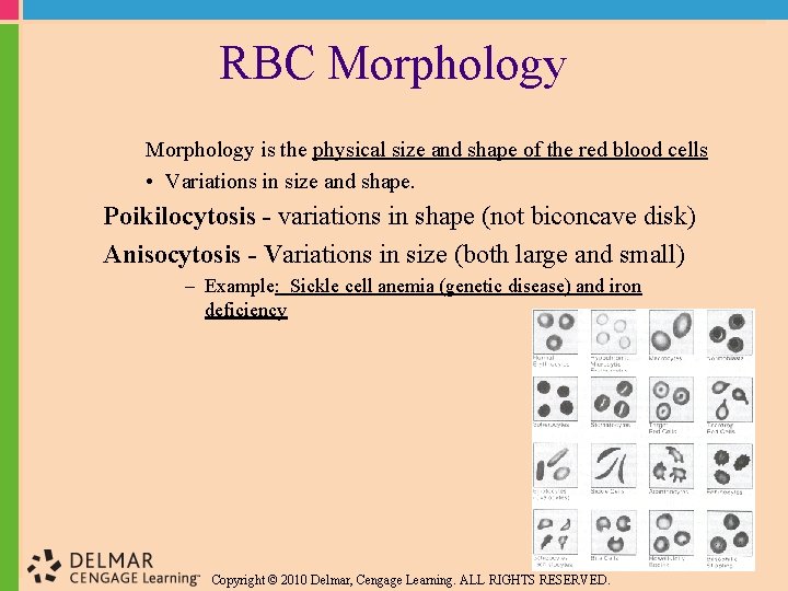 RBC Morphology is the physical size and shape of the red blood cells •