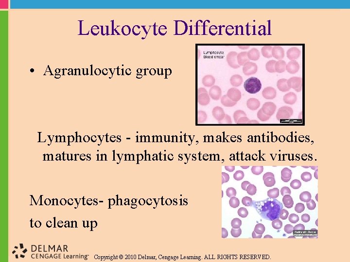 Leukocyte Differential • Agranulocytic group Lymphocytes - immunity, makes antibodies, matures in lymphatic system,