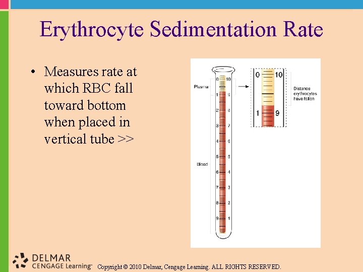 Erythrocyte Sedimentation Rate • Measures rate at which RBC fall toward bottom when placed