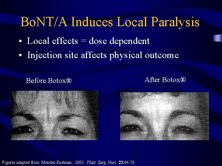 Bo. NT/A Induces Local Paralysis • Local effects = dose dependent • Injection site