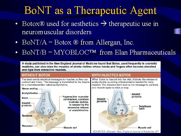 Bo. NT as a Therapeutic Agent • Botox® used for aesthetics therapeutic use in