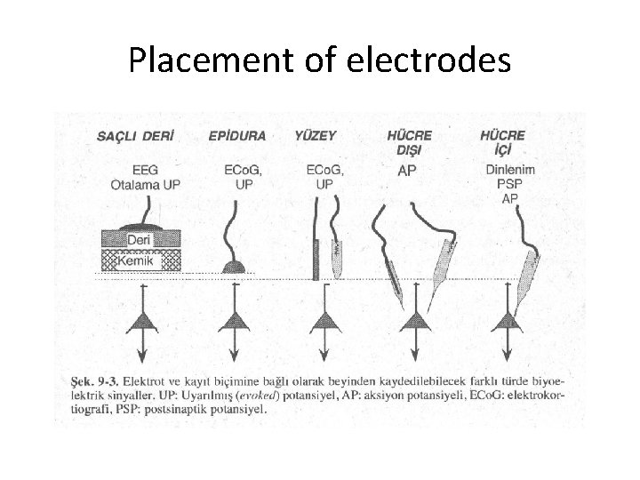 Placement of electrodes 