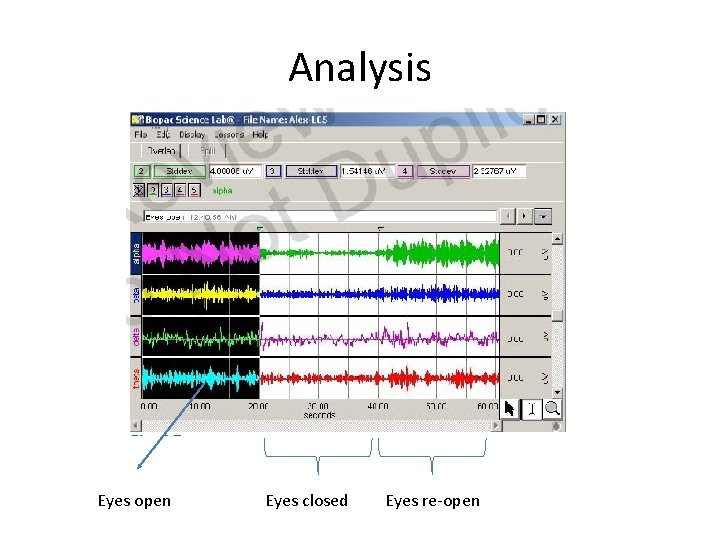Analysis Eyes open Eyes closed Eyes re-open 