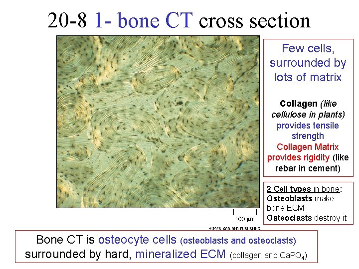 20 -8 1 - bone CT cross section Few cells, surrounded by lots of