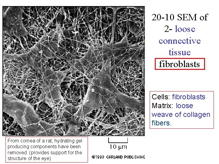 20 -10 SEM of 2 - loose connective tissue fibroblasts Cells: fibroblasts Matrix: loose
