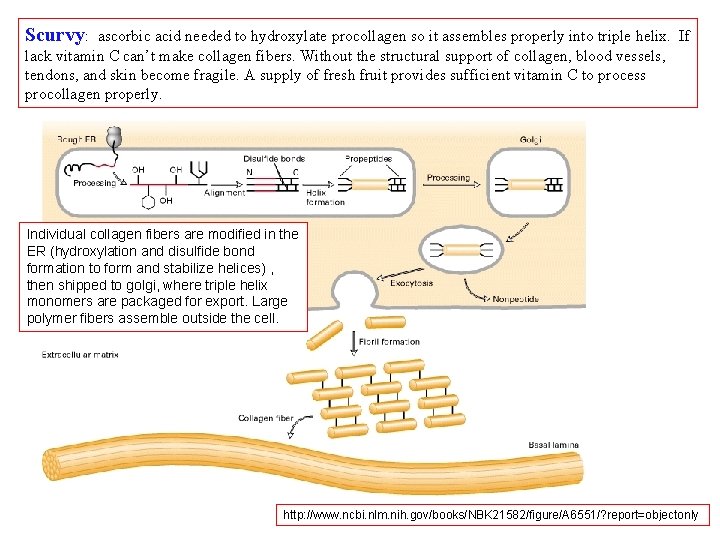 Scurvy: ascorbic acid needed to hydroxylate procollagen so it assembles properly into triple helix.