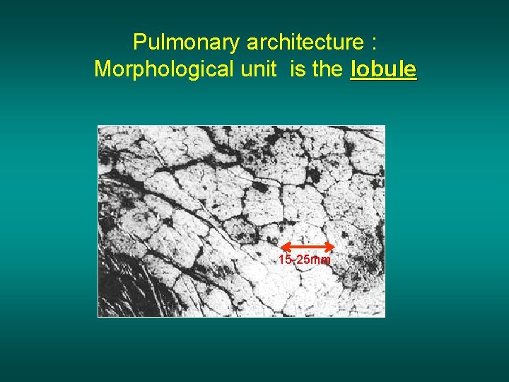Pulmonary architecture : Morphological unit is the lobule 15 -25 mm 