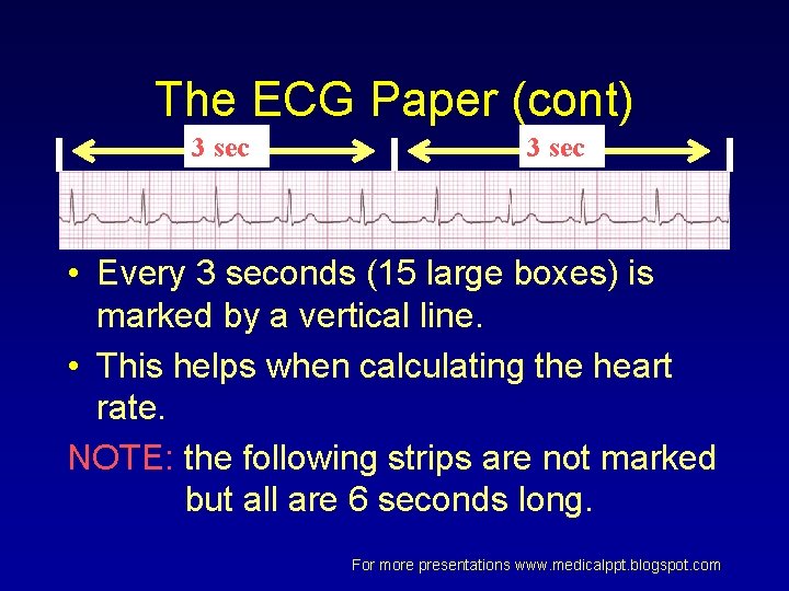 The ECG Paper (cont) 3 sec • Every 3 seconds (15 large boxes) is The ECG Paper (cont) 3 sec • Every 3 seconds (15 large boxes) is