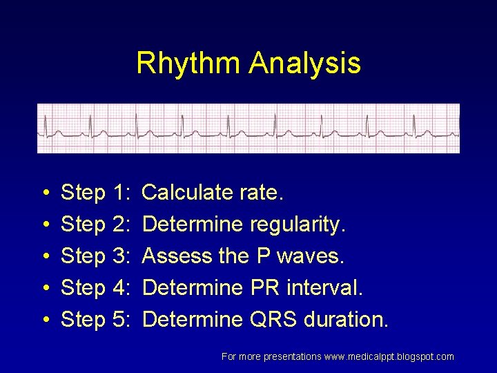 Rhythm Analysis • • • Step 1: Step 2: Step 3: Step 4: Step Rhythm Analysis • • • Step 1: Step 2: Step 3: Step 4: Step