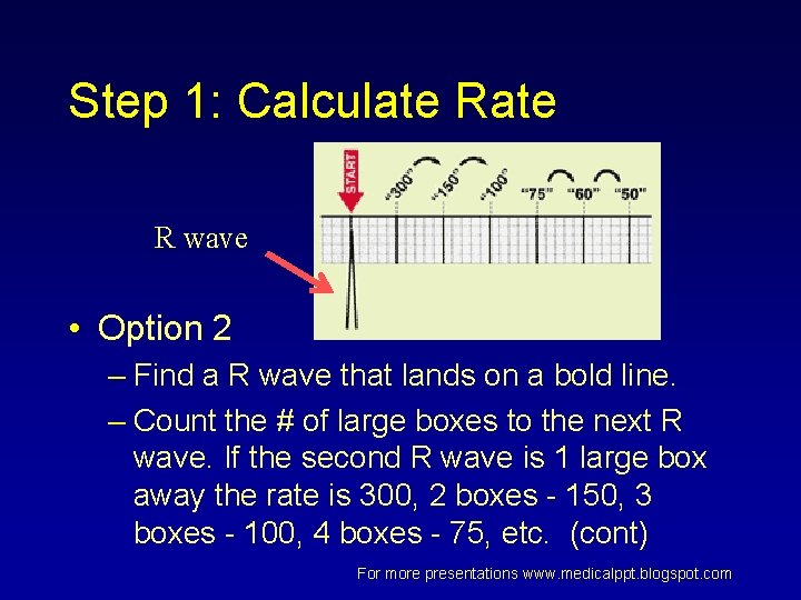 Step 1: Calculate R wave • Option 2 – Find a R wave that Step 1: Calculate R wave • Option 2 – Find a R wave that
