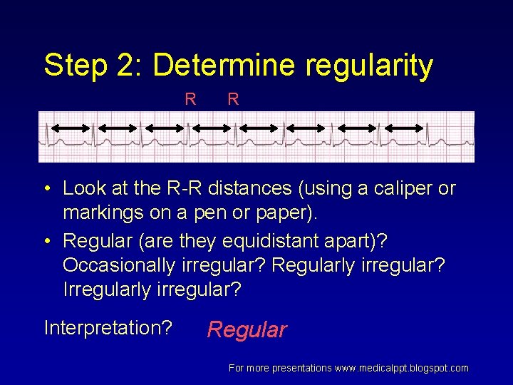 Step 2: Determine regularity R R • Look at the R-R distances (using a Step 2: Determine regularity R R • Look at the R-R distances (using a