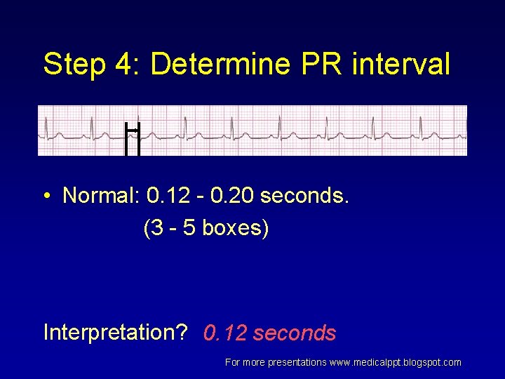 Step 4: Determine PR interval • Normal: 0. 12 - 0. 20 seconds. (3 Step 4: Determine PR interval • Normal: 0. 12 - 0. 20 seconds. (3