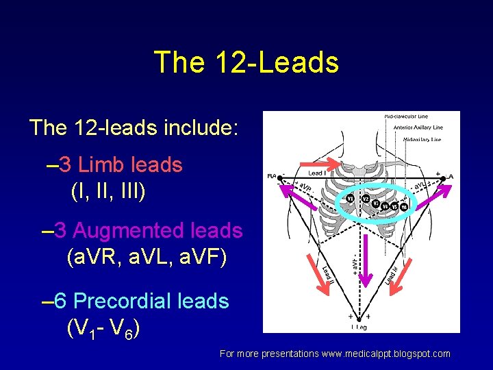 The 12 -Leads The 12 -leads include: – 3 Limb leads (I, III) – The 12 -Leads The 12 -leads include: – 3 Limb leads (I, III) –