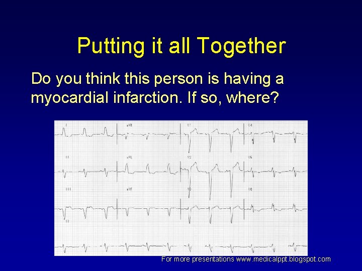 Putting it all Together Do you think this person is having a myocardial infarction. Putting it all Together Do you think this person is having a myocardial infarction.