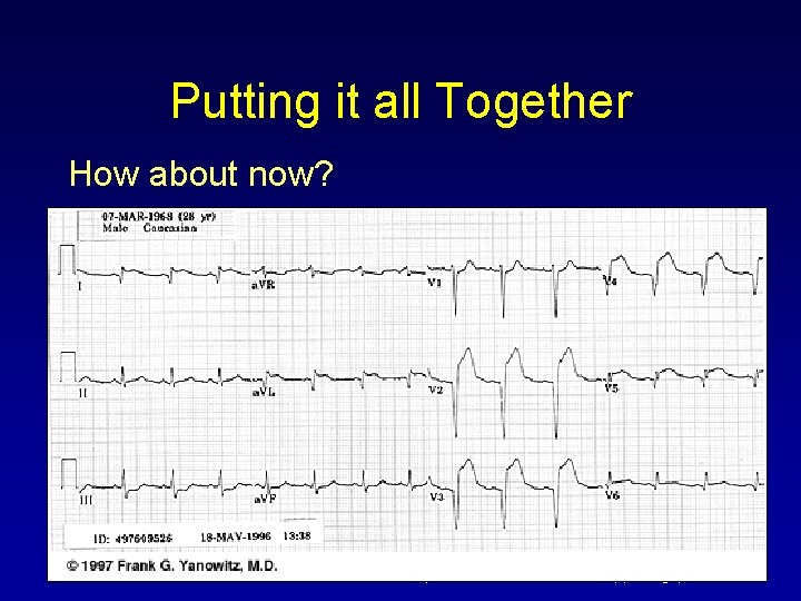 Putting it all Together How about now? For more presentations www. medicalppt. blogspot. com Putting it all Together How about now? For more presentations www. medicalppt. blogspot. com