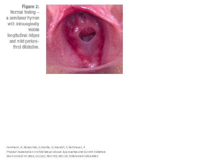 Herrmann, B; Banaschak, S; Csorba, R; Navratil, F; Dettmeyer, R Physical Examination in Child