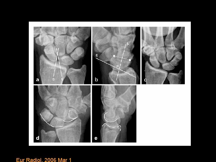 Eur Radiol. 2006 Mar 1 