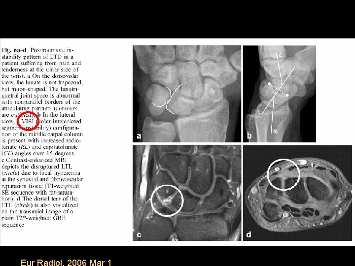 Eur Radiol. 2006 Mar 1 