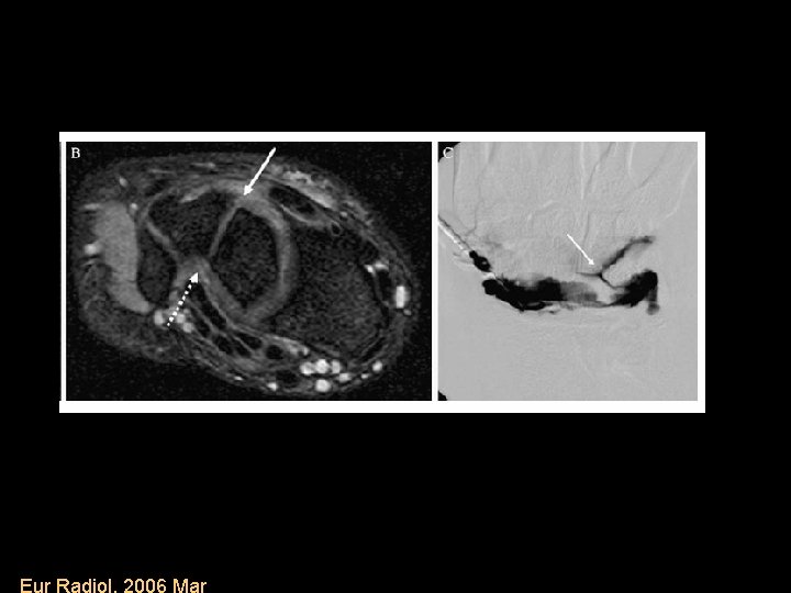 Eur Radiol. 2006 Mar 
