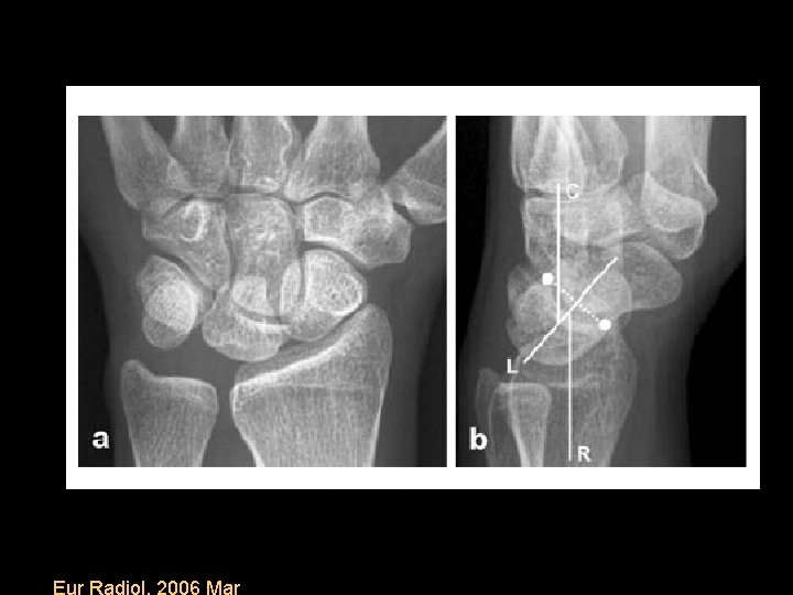 Eur Radiol. 2006 Mar 