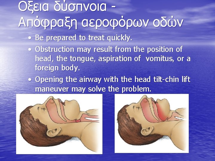 Οξεια δύσπνοια Απόφραξη αεροφόρων οδών • Be prepared to treat quickly. • Obstruction may