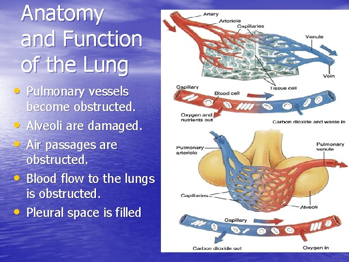 Anatomy and Function of the Lung • Pulmonary vessels • • become obstructed. Alveoli