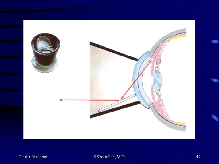 Ocular Anatomy S. Khairallah, M. D. 49 