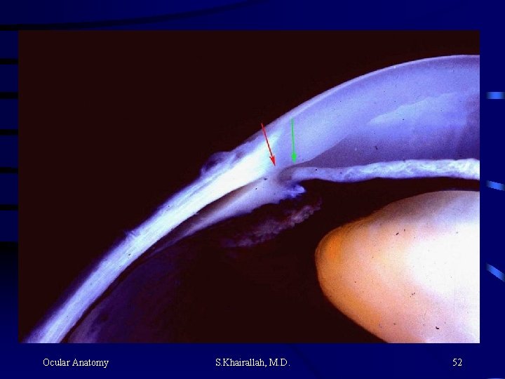 Ocular Anatomy S. Khairallah, M. D. 52 