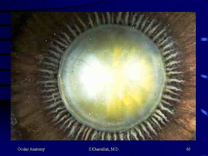 Ocular Anatomy S. Khairallah, M. D. 60 