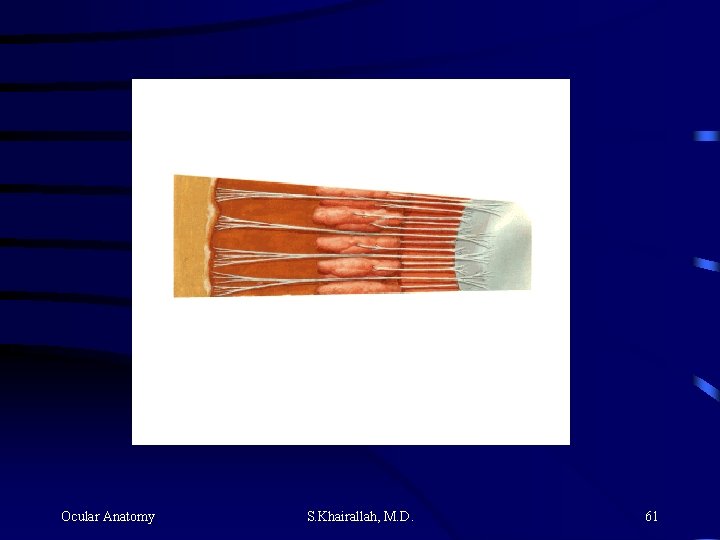 Ocular Anatomy S. Khairallah, M. D. 61 Ocular Anatomy S. Khairallah, M. D. 61
