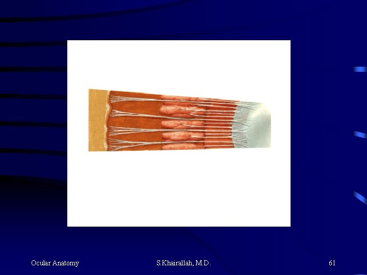 Ocular Anatomy S. Khairallah, M. D. 61 