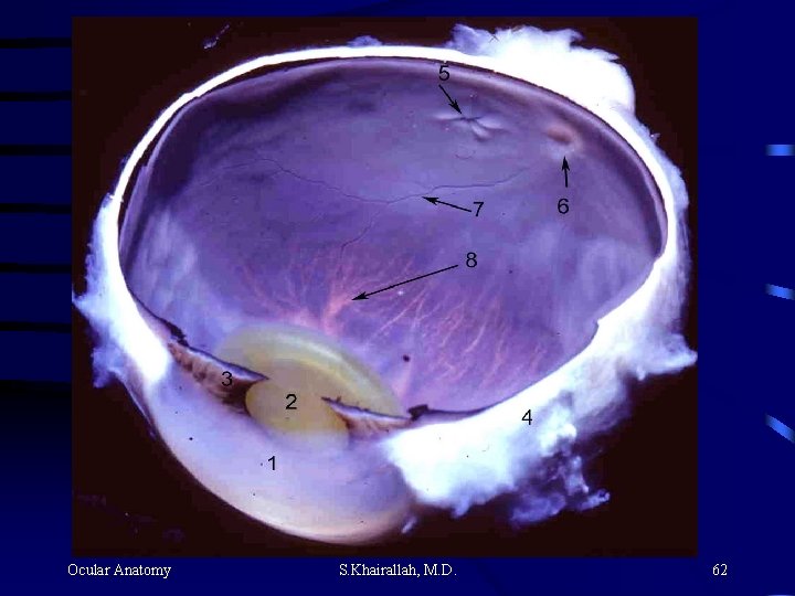 Ocular Anatomy S. Khairallah, M. D. 62 Ocular Anatomy S. Khairallah, M. D. 62