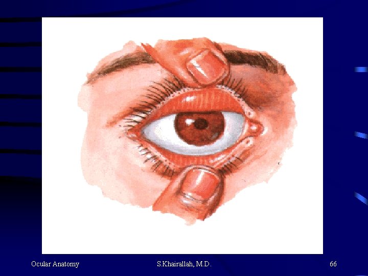 Ocular Anatomy S. Khairallah, M. D. 66 