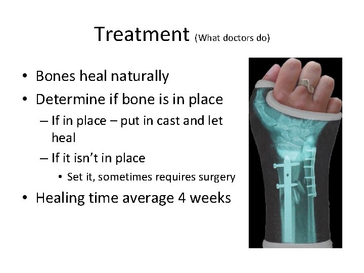 Treatment (What doctors do) • Bones heal naturally • Determine if bone is in