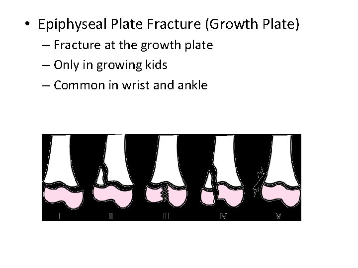  • Epiphyseal Plate Fracture (Growth Plate) – Fracture at the growth plate –
