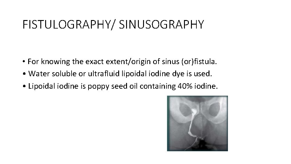 FISTULOGRAPHY/ SINUSOGRAPHY • For knowing the exact extent/origin of sinus (or)fistula. • Water soluble