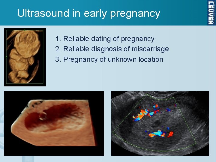 Ultrasound in early pregnancy 1. Reliable dating of pregnancy 2. Reliable diagnosis of miscarriage