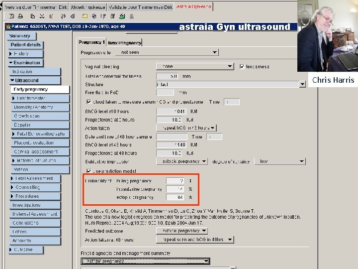astraia Gyn ultrasound Chris Harris 