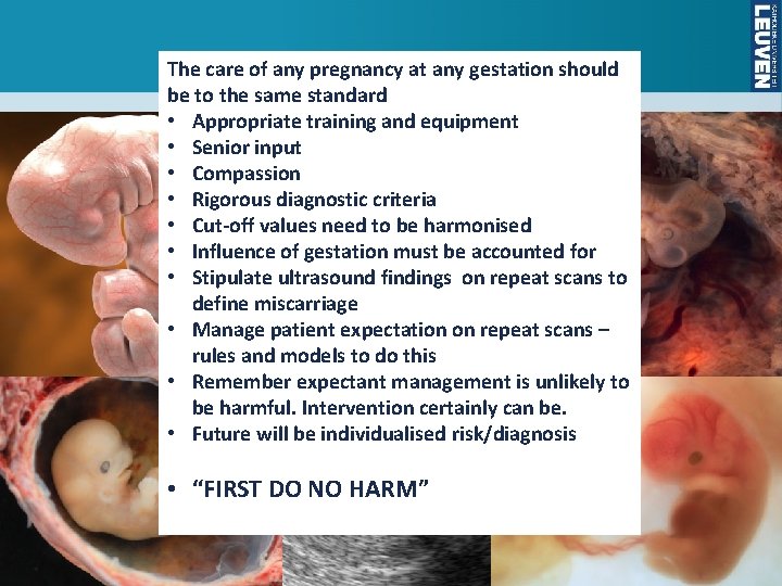 The care of any pregnancy at any gestation should be to the same standard